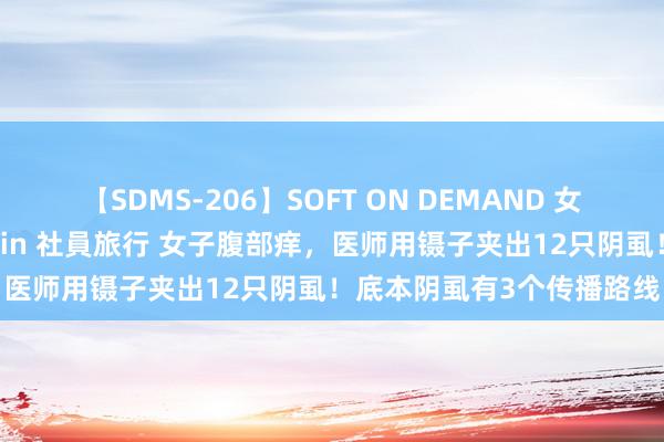 【SDMS-206】SOFT ON DEMAND 女子社員スペシャル野球拳 in 社員旅行 女子腹部痒，医师用镊子夹出12只阴虱！底本阴虱有3个传播路线